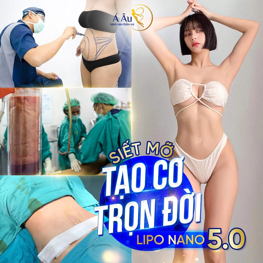 Cơ hội tư vấn, hút mỡ cùng bác sĩ đầu ngành