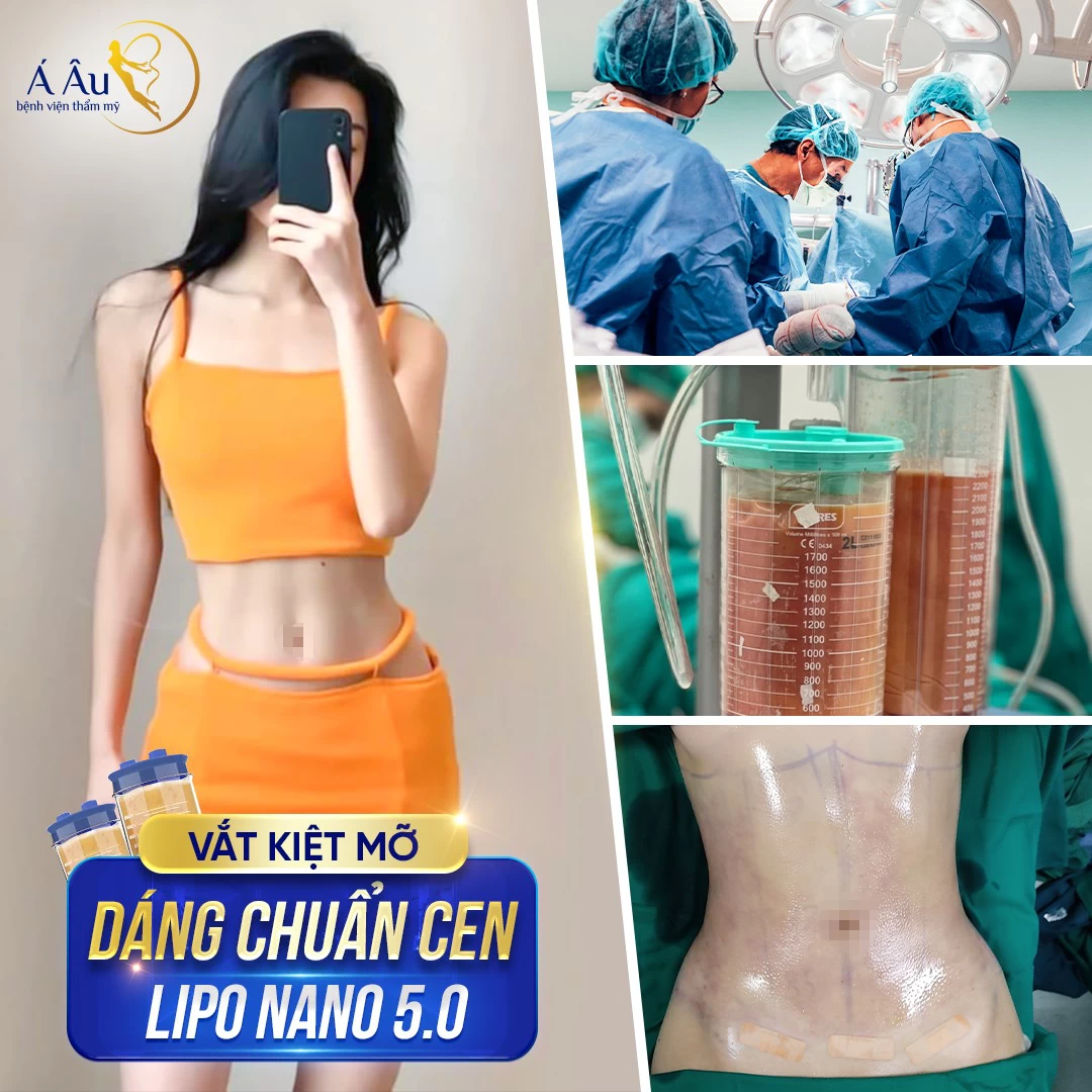 Hút mỡ được thực hiện trên nhiều vùng khác nhau trên cơ thể