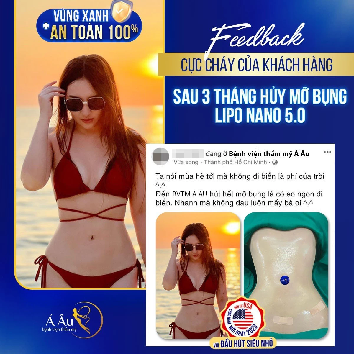 Hình ảnh chị Lan Thi sau khi hút mỡ bụng Lipo Nano 5.0 sau 3 tháng khiến không ít người trầm trồ khen ngợi