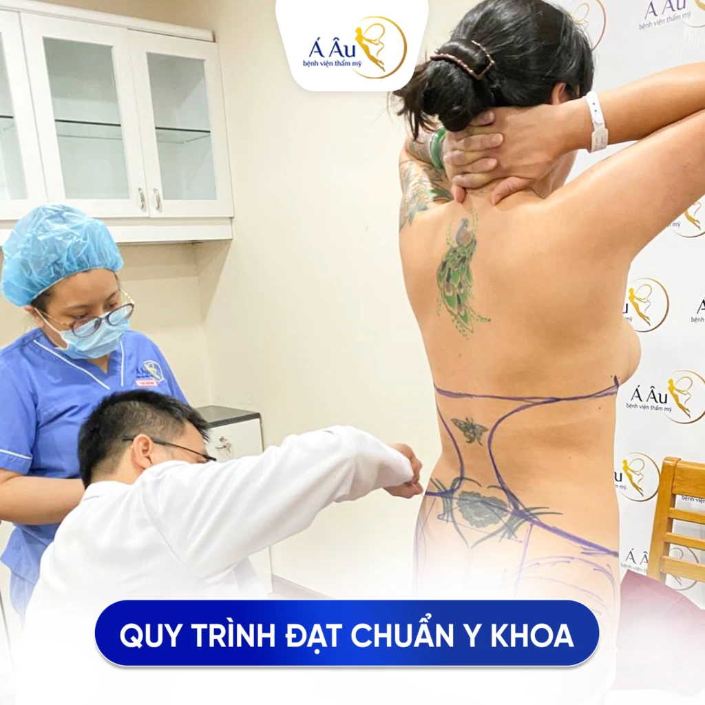 Hút mỡ bụng bao nhiêu tiền tại Tp.Hồ Chí Minh? 17