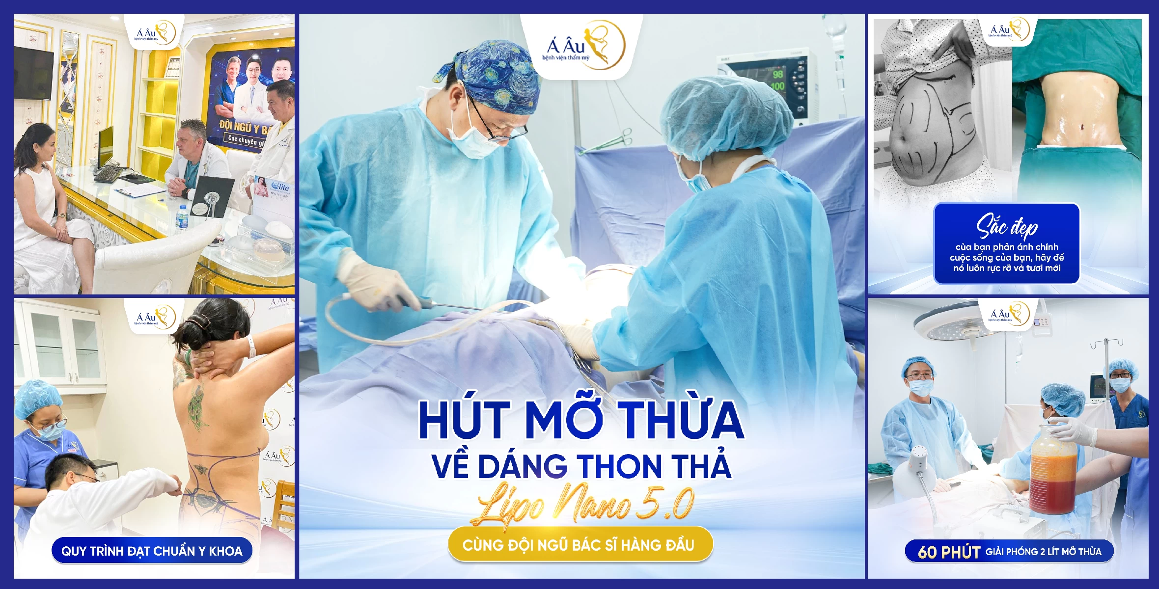 Hút mỡ bụng bao nhiêu tiền tại Bệnh viện thẩm mỹ Á Âu 
