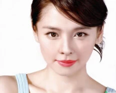 Thẩm mỹ hút mỡ mặt có hiệu quả và an toàn không? - Sua mui o dau an toan 1