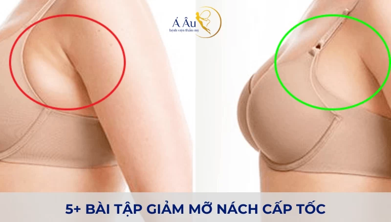 5+ bài tập giảm mỡ nách cấp tốc. Không thể bỏ qua! - bai tap giam mo nach 1 1