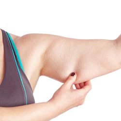đối tượng hút giảm mỡ bắp tay