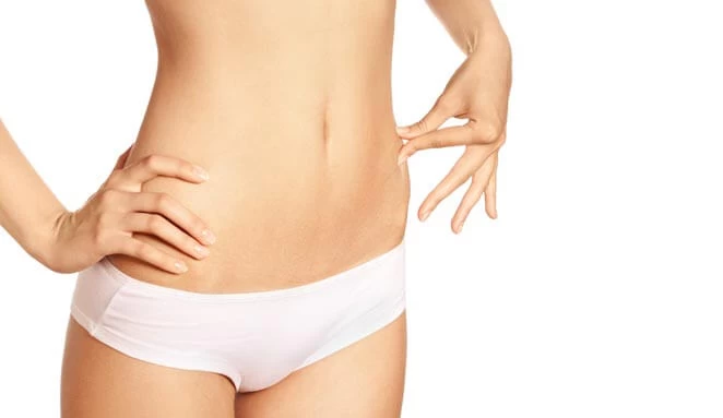 Hậu quả hút mỡ bụng có nguy hiểm không? - hau qua hut mo bung 1
