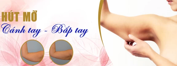 Hút mỡ bắp tay bằng Pharaon Lipo