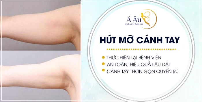 Hút mỡ bắp tay phải được thực hiện tại bệnh viện