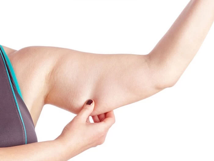 Mỡ bắp tay làm cho thân hình cuồn cuộn