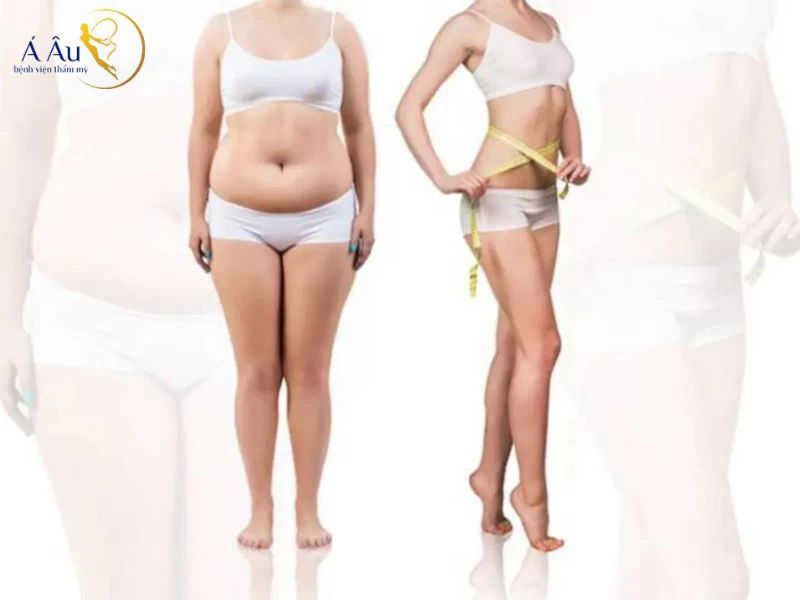 Hút mỡ bụng có béo lại không?
