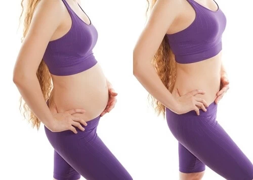 Hút mỡ bụng không phẫu thuật 1 lan duy nhat 7 hút mỡ bụng không phẫu thuật 1 lan duy nhat