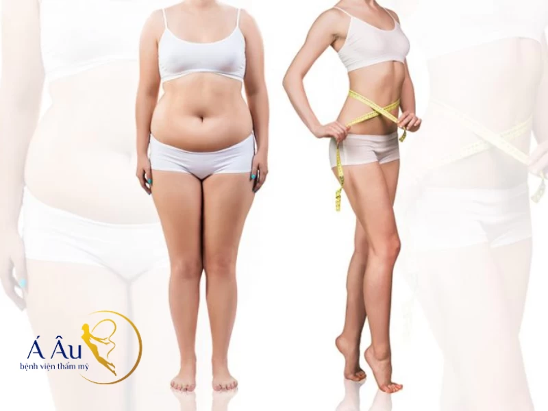Chú ý những điều cần tránh khi chăm sóc sau hút mỡ bụng