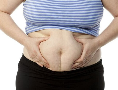 Hút mỡ thừa bằng Body jet như nào?