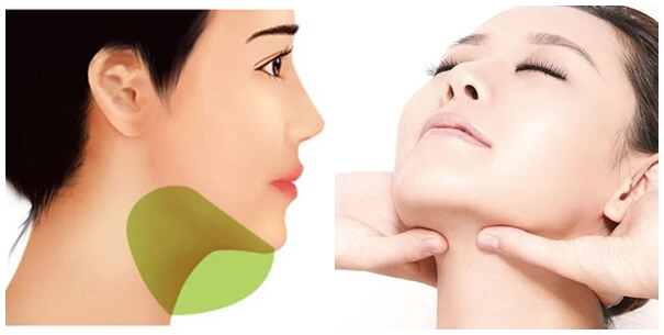 Hút mỡ mặt có đau không? - hut mo mat.