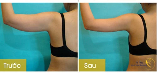 Hình ảnh kết quả thực hiện của khách hàng(*)