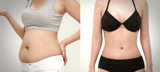 Hút mỡ bụng nâng ngực – Giải pháp nâng ngực tự nhiên - ket qua hut mo bung an toan 9
