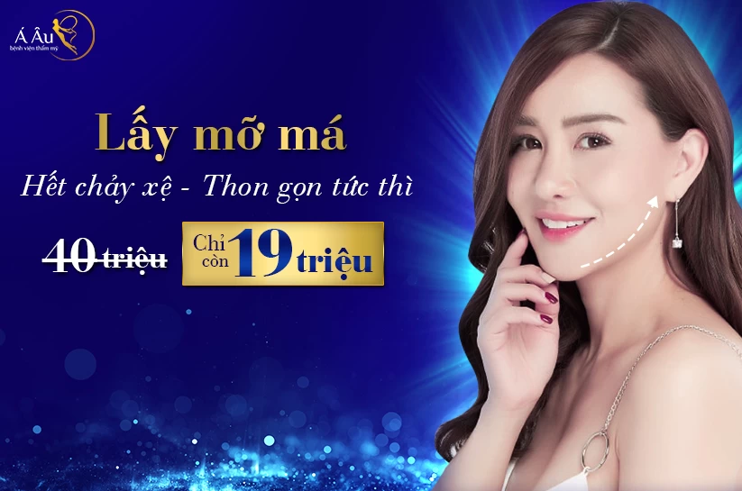 Hủy mỡ nọng cằm không phẫu thuật - laymoma