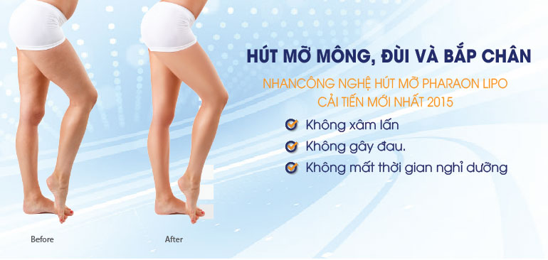 Mỡ thừa bắp chân nên khắc phục thế nào? - mo thua bap chan..