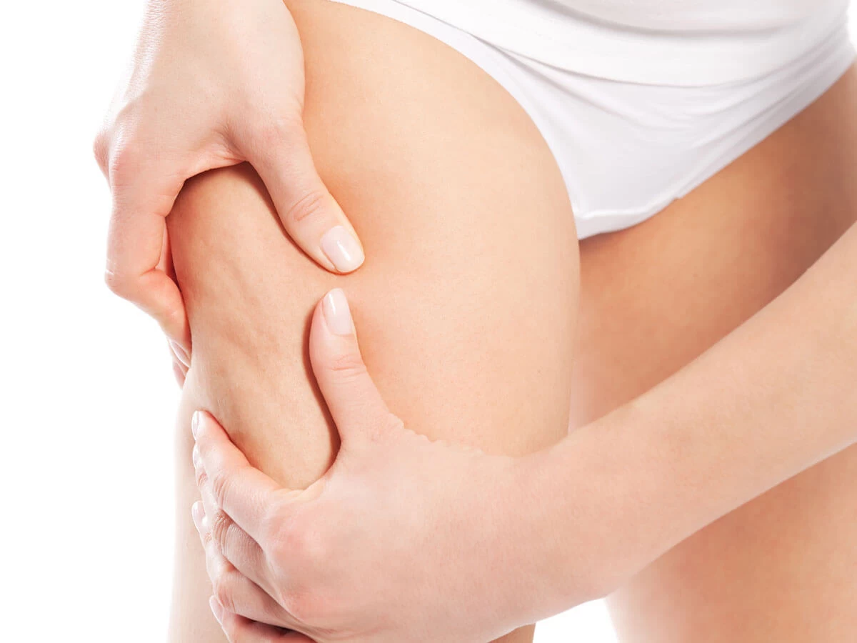Mỡ đùi làm ngoại hình xuống cấp