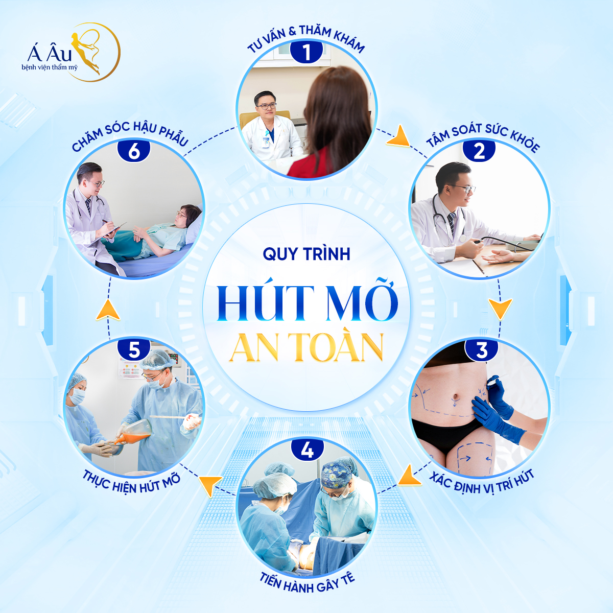 Quy trình hút mỡ an toàn tại Bệnh viện Thẩm mỹ Á Âu
